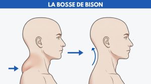 bosse de bison