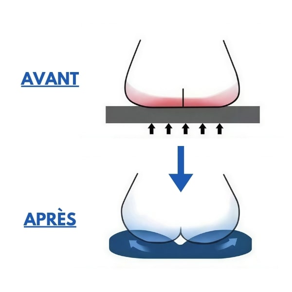 coussin pour hemorroïdes pharmacie