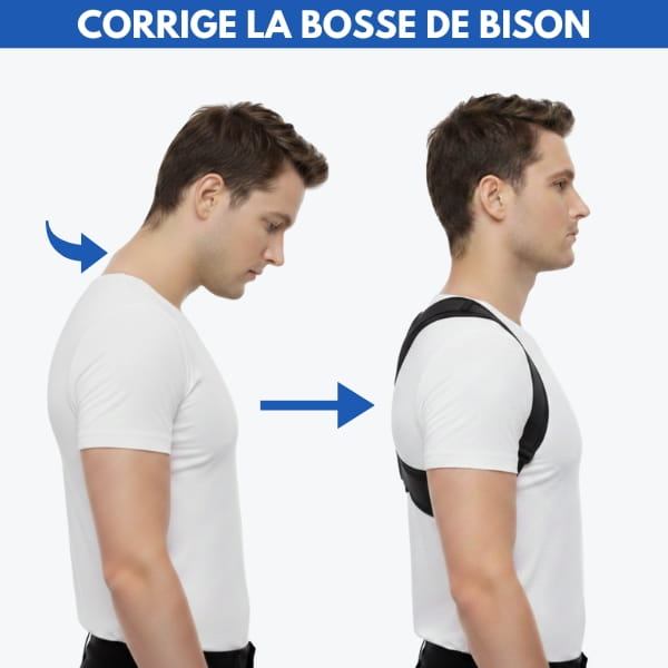 redresse dos bosse de bison