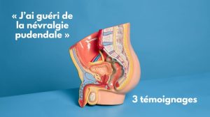 j'ai guéri de la névralgie pudendale