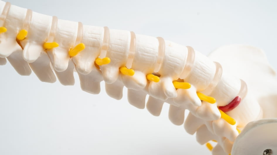 spondylarthrite ankylosante témoignage